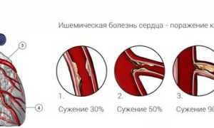 Как и при каком давлении используют таблетки Кордафен в соответствии с инструкцией по применению?