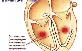 Особенности применения таблеток Соталол и их аналогов, обзор отзывов кардиологов