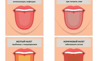 Почему у ребенка на языке желтый налет и горечь во рту