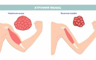 Гипотрофия (хронический недобор веса) у детей