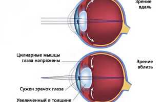 Спазм аккомодации у детей – что это такое?