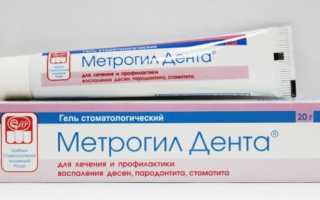 Мази для десен от воспаления: Метрогил Дента, Холисал, Криогель и другие стоматологические гели