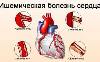 При каком давлении и как принимать таблетки Кордафлекс по инструкции по применению, что говорится в отзывах и какие существуют доступные аналоги?