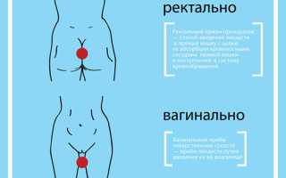 Свечи от анальнальной трещины