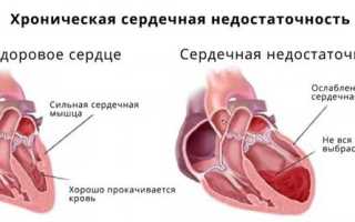 Плюсы и минусы таблеток Лизиноприл Астрафарм