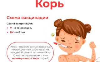 Корь у детей – симптомы, лечение и прививки от инфекции