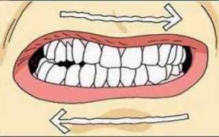 Что делать, если заклинило челюсть в домашних условиях – как вправить самостоятельно