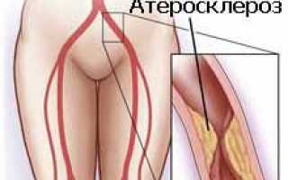 Подвздошная артерия — строение, функции и патологии