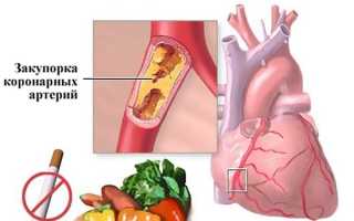 Первичная и вторичная профилактика ИБС
