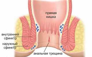 Преимущества и недостатки свечей Бетиол: применение по инструкции и сравнение с аналогами