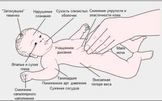 Обезвоживание у ребенка