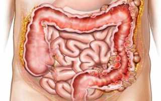 Как проводится диагностика кишечника