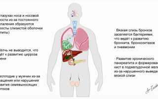 Муковисцидоз у детей – смертельное генетическое заболевание