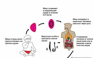 Как обнаружить и вывести острицы у ребенка?