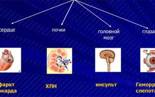 Какую форму Зокардис советует выбирать инструкция по применению?
