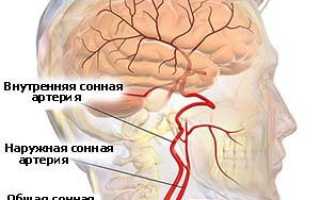 Сонная артерия — анатомии, функций и патологий