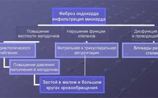 Что такое рестриктивная кардиомиопатия?