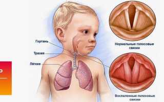 Пропал голос у ребенка – что делать?