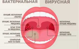 Почему у ребенка красное горло