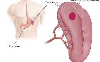 Киста селезёнки у ребёнка