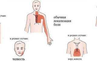 Что делать, если мучает ноющая боль в области сердца?