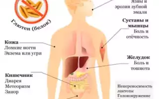 Целиакия – непереносимость глютена у детей