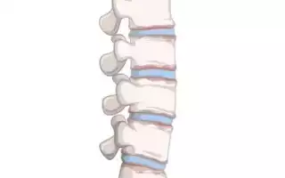 Лечение болезней позвоночника у детей в Израиле