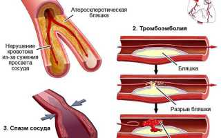 Как применять Теночек по инструкции и какими аналогами можно заменить эти таблетки с уникальным составом?