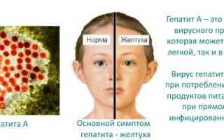 Гепатит В у детей