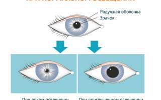 Светобоязнь у ребёнка – почему так больно смотреть на свет