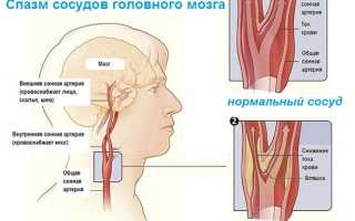 Как снять спазм сосудов у ребенка?