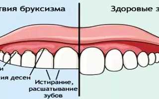 Почему ребенок скрипит зубами во сне и что с этим делать?