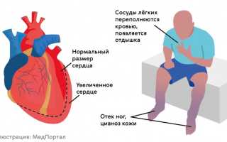 Блокада сердца у ребенка