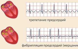 Состав таблеток Дигоксин и особенности их применения по инструкции и отзывам, в сравнении с аналогами