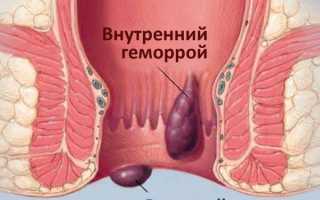 Применение мазей «Гепатромбин» и «Гепатромбин Г»: от чего помогают, обзор инструкций и отзывов