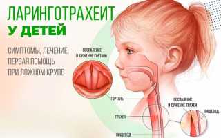 Как и чем лечить ларинготрахеит у ребенка