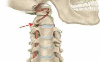 Позвоночная артерия — анатомия, функции и патологии