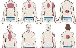 По каким симптомам определить, что болит именно сердце?