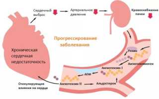 Причины, симптомы, клинические рекомендации по лечению и прогноз жизни при хронической сердечной недостаточности