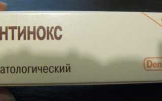 Стоматологический гель Холисал: инструкция по применению при воспалении десен и зубной боли