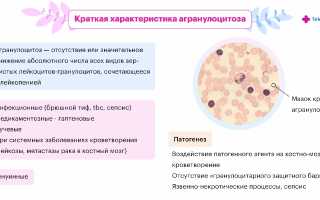 Агранулоцитоз у детей
